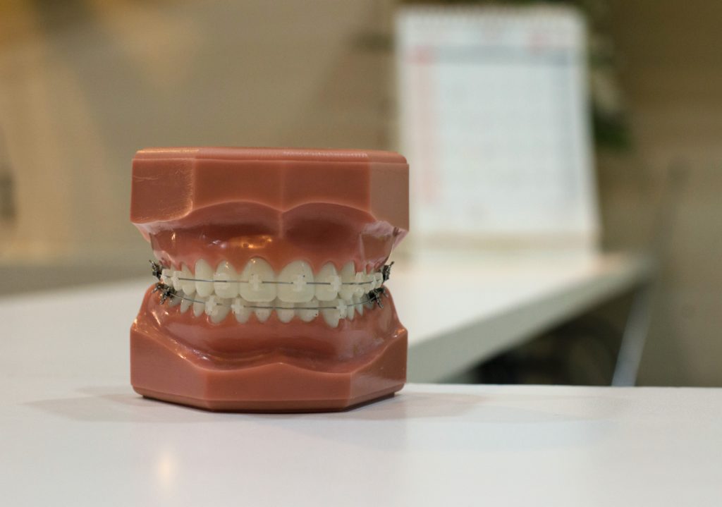 A denture with braces on top of a table